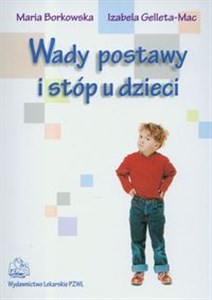 Picture of Wady postawy i stóp u dzieci
