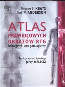 Picture of Atlas prawidłowych  obrazów RTG imitujących stan patologiczny