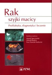 Picture of Rak szyjki macicy Profilaktyka, diagnostyka i leczenie