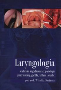 Obrazek Laryngologia wybrane zagadnienia z patologii jamy ustnej, gardła, krtani i okolic