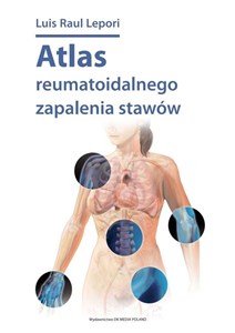 Obrazek Atlas reumatoidalnego zapalenia stawów / DK Media