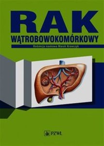 Picture of Rak wątrobowokomórkowy