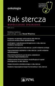 Picture of Rak stercza Współczesne spojrzenie W gabinecie lekarza specjalisty. Onkologia
