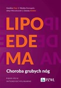 Polska książka : Lipoedema ... - Karolina Chęś, Monika Domagała, Artur Mieczkowski, Dorota Stettler
