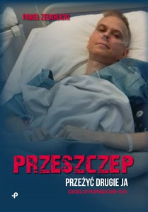 Picture of Przeszczep