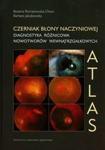 Obrazek Czerniak błony naczyniowej Diagnostyka różnicowa nowotworów wewnątrzgałkowych Atlas