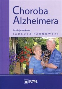 Obrazek Choroba Alzheimera