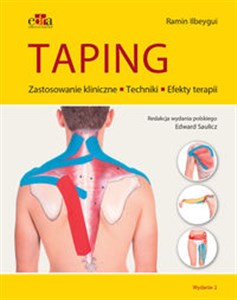 Picture of Taping Zastosowanie kliniczne Techniki Efekty terapii