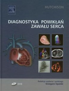Picture of Diagnostyka powikłań zawału serca
