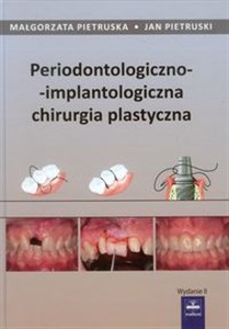 Obrazek Periodontologiczno-implantologiczna chirurgia plastyczna