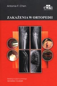 Picture of Zakażenia w ortopedii