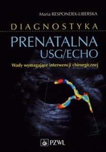 Picture of Diagnostyka prenatalna USG/ECHO Wady wymagające interwencji chirurgicznej