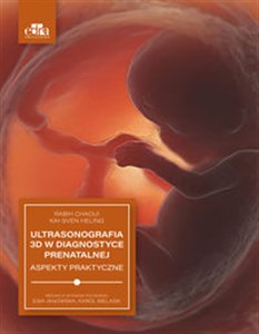 Obrazek Ultrasonografia 3D w diagnostyce prenatalnej