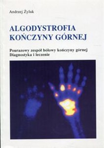 Picture of Algodystrofia kończyny górnej Pourazowy zespół bólowy kończyny górnej. Diagnostyka i leczenie