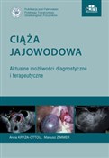 Ciąża jajo... - A. Kryza-Ottou, M. Zimmer -  Polish Bookstore 