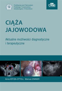 Picture of Ciąża jajowodowa Aktualne możliwości diagnostyczne i terapeutyczne