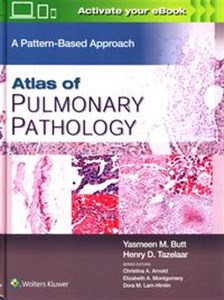 Obrazek Atlas of Pulmonary Pathology A Pattern Based Approach, First edition