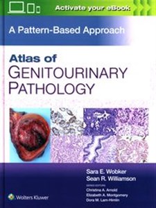 Obrazek Atlas of Genitourinary Pathology A Pattern Based Approach, First edition