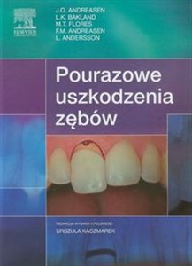 Picture of Pourazowe uszkodzenia zębów