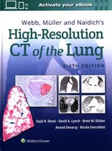 Obrazek Webb, Müller and Naidich's High-Resolution CT of the Lung Sixth edition