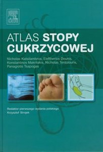 Obrazek Atlas stopy cukrzycowej