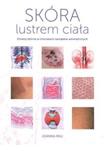Picture of Skóra lustrem ciała /  Item Publishing Zmiany skórne w chorobach narządów wewnętrznych