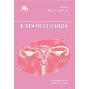 Picture of Endometrioza