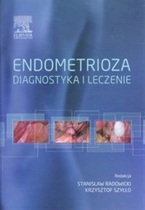 Picture of Endometrioza diagnostyka i leczenie