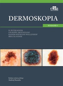 Picture of Dermoskopia