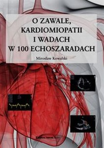 Picture of O zawale kardiomiopatii i wadach w 100 echoszaradach