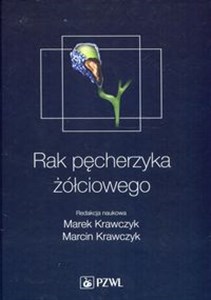 Picture of Rak pęcherzyka żółciowego