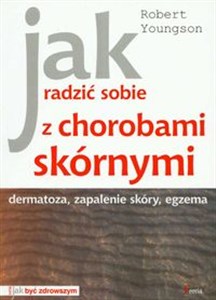 Picture of Jak radzić sobie z chorobami skórnymi dermatoza, zapalenie skóry, egzema